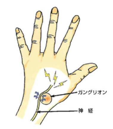 スクリーンショット 2026-01-09 004051.png_380px.jpg